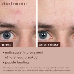 Daily Meds -Yogaye Ventas 4 spot defy daily meds BA 1 PDP 0d02bf3c c5a4 4b5b 808f 908242631794 1