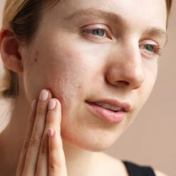 Pore Thing -Yogaye Ventas 5 pore thing PDP model female