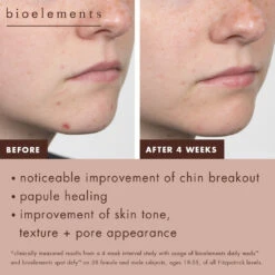 Daily Meds -Yogaye Ventas 5 spot defy daily meds BA 1 PDP 7338dbe0 0712 4568 8be3 9033c0d5ee30 1