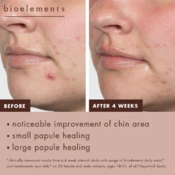 Daily Meds -Yogaye Ventas 6 spot defy daily meds BA 1 PDP 2d6d7f53 9dee 48cf 96a6 769f524ee7cb 1