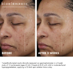 Vc10 Dark Spot Solution -Yogaye Ventas vc10 dark spot solution PDP pos 4 b1be3f44 ff7a 4f68 951d e1d54a6fb83d