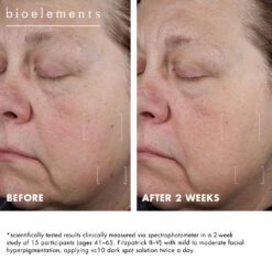 Vc10 Dark Spot Solution -Yogaye Ventas vc10 dark spot solution PDP pos 5 35387088 32e1 4a7e bc93 e7816594f833