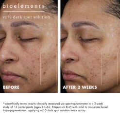 Vc10 Daily Glow + Vc10 Dark Spot Solution Bundle -Yogaye Ventas vc10 dark spot solution name BA subj 3